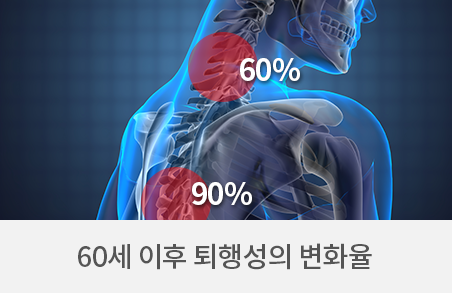 퇴행성의 변화율